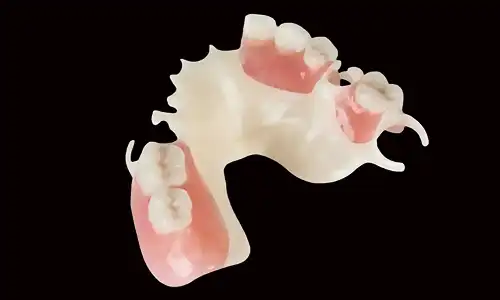 PEEK Framework Offers Lightweight Alternatives for Dental Prosthetics